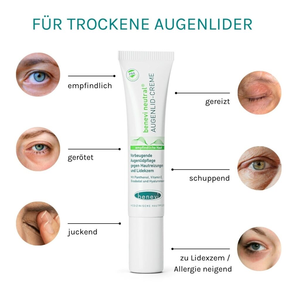 Elegantes Trockene Augenlider Hausmittel Ebenbild