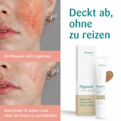 ROSAZEA Pigmentcreme 3 dunkel