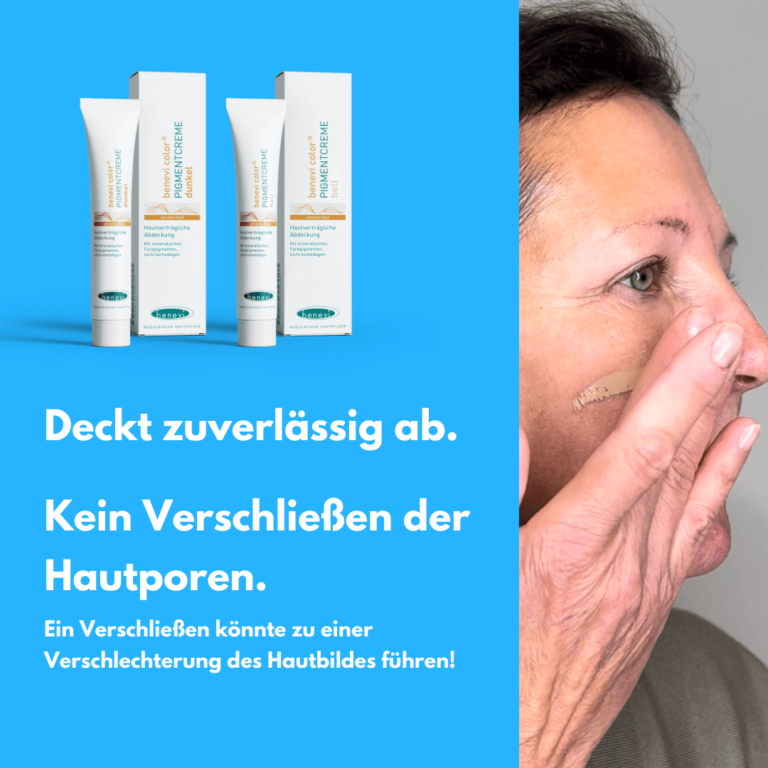 Pigmentcreme benevi color Akneläsionen abdecken